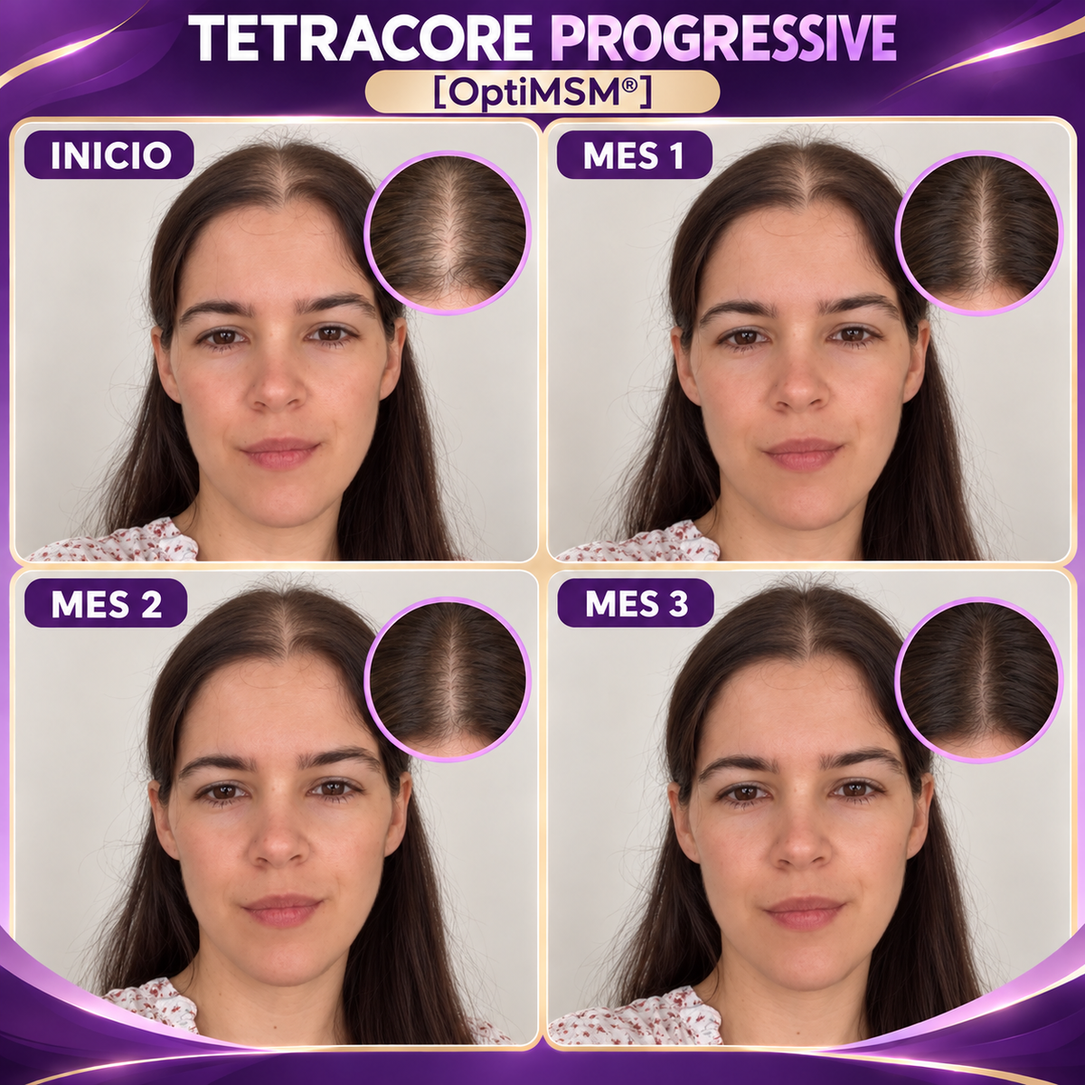 TETRACORE PROGRESSIVE [OptiMSM®]