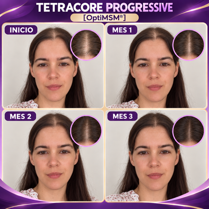 TETRACORE PROGRESSIVE [OptiMSM®]